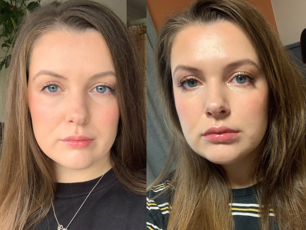 Before and after Dr Dennis Gross lip plumping product | Space NK
