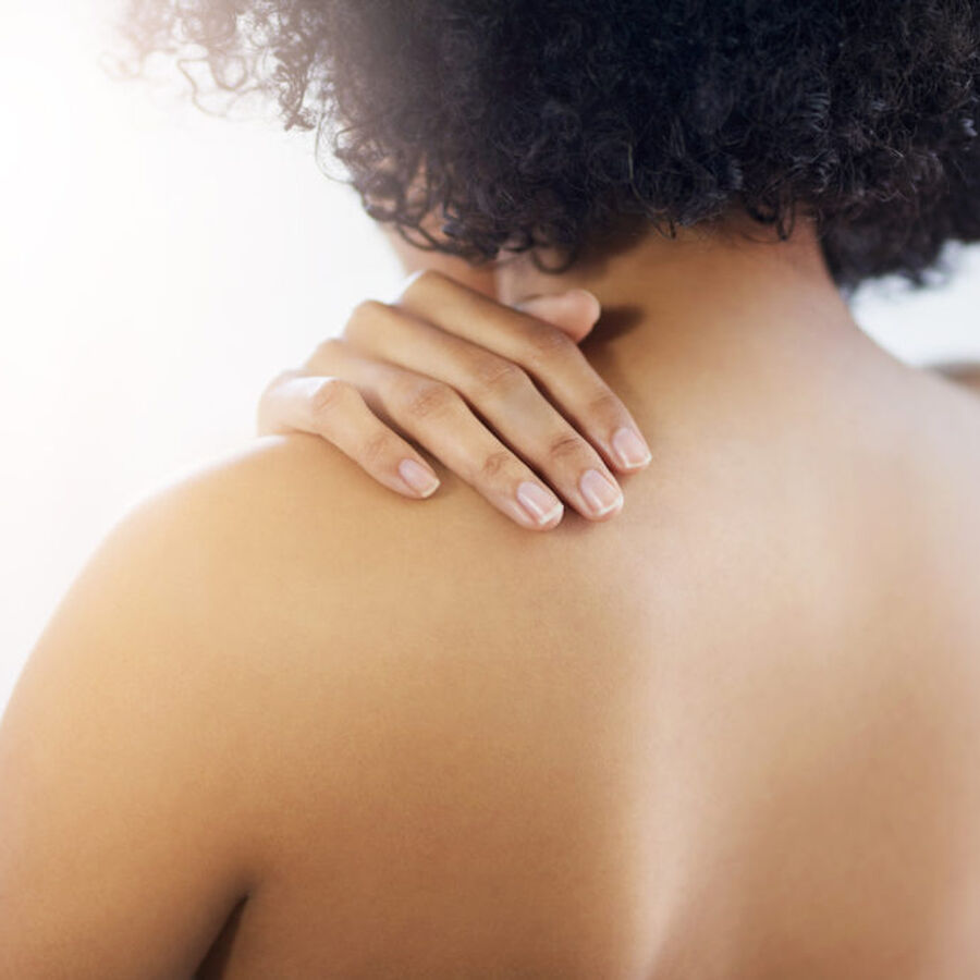 Hoe omgaan met acne op het lichaam