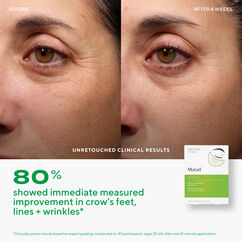 Retinol Youth Renewal Eye Masks, , large, image4