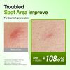 Azelaic Acid 10 Hyaluronic Redness Soothing Serum, , large, image9
