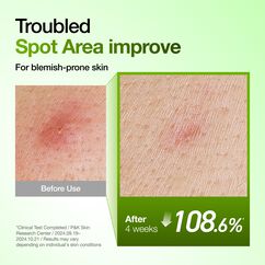 Azelaic Acid 10 Hyaluronic Redness Soothing Serum, , large, image9