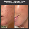 Skin Perfecting 2% BHA Liquid Exfoliant, , large, image5