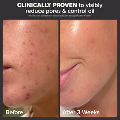 Skin Perfecting 2% BHA Liquid Exfoliant, , large, image5