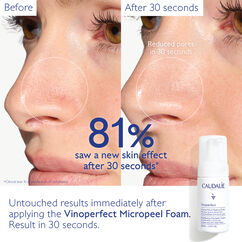 Vinoperfect Brightening Micropeel, , large, image4