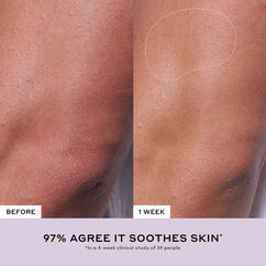 Après Skin Multi-Use Rich Rescue Crème, , large, image6