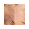 Supernatural Blemish Face Serum, , large, image7