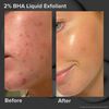 Skin Perfecting 2% BHA Liquid Exfoliant, , large, image6