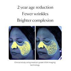 Night Cream, , large, image8