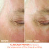 Alpha Beta Ultra Gentle Daily Peel, , large, image4