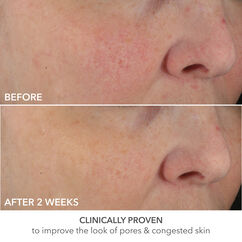 Advanced Retinol + Ferulic Perfectly Dosed Retinol Universal 0.2%, , large, image11
