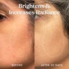 Star Bright Vitamin C Discolouration Correcting Serum, , large, image9