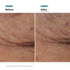 P-TIOX Serum, , large, image6