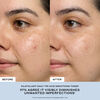 Silkfoliant Daily Tri-Acid Smoothing Toner, , large, image4