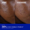 Daily Renewing Soft Peel, , large, image6