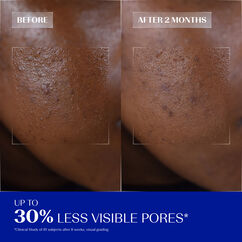 Daily Renewing Soft Peel, , large, image6