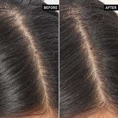 Salicylic Acid Exfoliating Scalp Treatment, , large, image3
