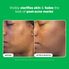 10% Azelaic Acid Booster, , large, image4