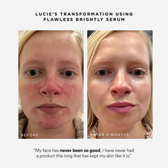 Flawless Brightly Serum, , large, image4