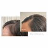 Traitement de rajeunissement des cheveux (nutriment phyto-folliculaire), , large, image2