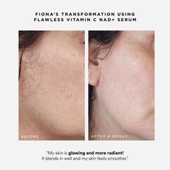Flawless Vitamin C NAD+ Serum, , large, image4