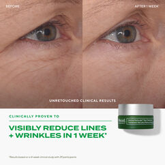 Retinal ReSculpt&trade; Eye Treatment, , large, image7