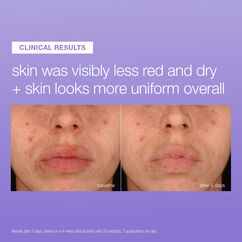 Stabilising Repair Serum, , large, image4