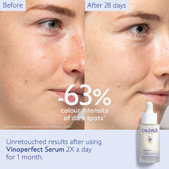 Vinoperfect Brightening Dark Spot Serum, , large, image7