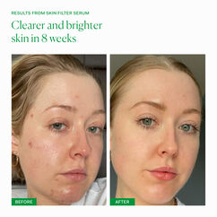 Skin Filter Serum, , large, image4