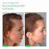 Growth Phase, , large, image5