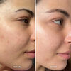 Liquid Gold with 5% Glycolic Acid, , large, image11