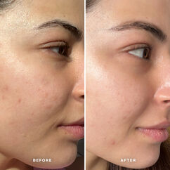 Liquid Gold with 5% Glycolic Acid, , large, image11