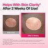 Niacinamide 10% + TXA 4% Serum, , large, image8