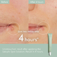 Vinopure Salicylic Spot Stop, , large, image6