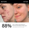 15% Vitamin C + EGF Serum, , large, image5