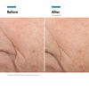 Triple Lipid Restore 2:4:2, , large, image9