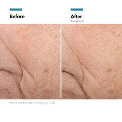 Triple Lipid Restore 2:4:2, , large, image9