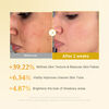 Kojic Acid Turmeric Resurfacing Toner, , large, image9