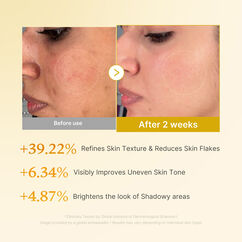 Kojic Acid Turmeric Resurfacing Toner, , large, image9