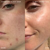 Supernatural Blemish Face Serum, , large, image7