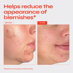 Clear Targeted Serum, , large, image5