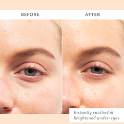 Skin Remedy Soothing Eye Gels, , large, image3