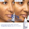 Vinoperfect Brightening Dark Spot Serum, , large, image9