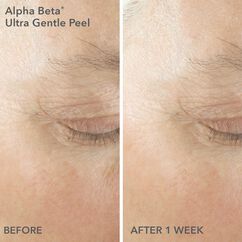 Limited Edition Spring Kit: Alpha Beta® Smooth, Radiant, Firm For Sensitive/Normal Skin, , large, image5