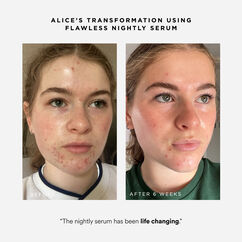 Flawless Nightly Serum, , large, image5