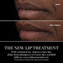 Lip Treatment, HONEY, large, image11