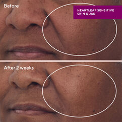 Heartleaf Gentle Resurfacing Serum, , large, image4