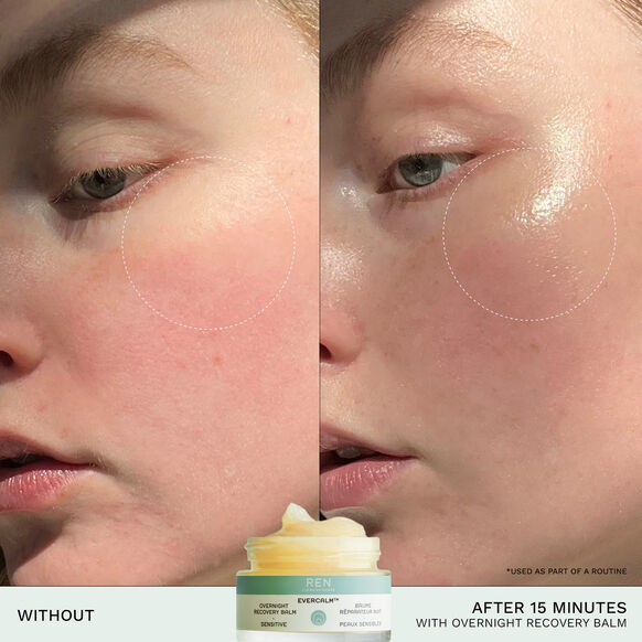Evercalm Overnight Recovery Balm, , large, image4
