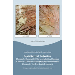 Scalp Revival Soothe and Detoxify Hair Care Minis, , large, image3
