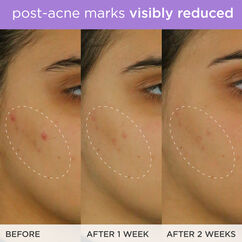 The Brightening Serum, , large, image9