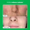 10% Azelaic Acid Booster, , large, image9